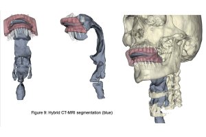 David Meyer's 3D Model