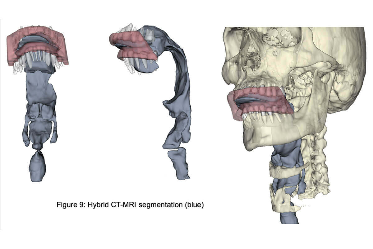 Article on Creating 3D Models of Airspace in Throat by Meyer Published in Journal of Voice